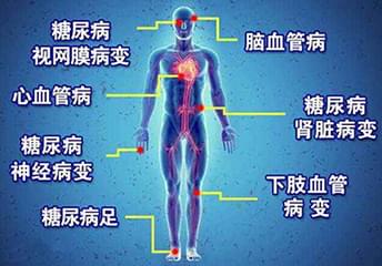 糖尿病并发症概述