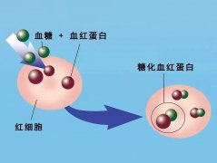 糖化血红蛋白可以提高糖尿病诊断效率
