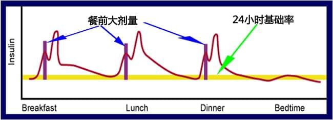 <a href='http://www.dana11.com/ktzs/ydsbbd/93.html' target='_blank'><u>胰岛素泵剂量</u></a>调剂